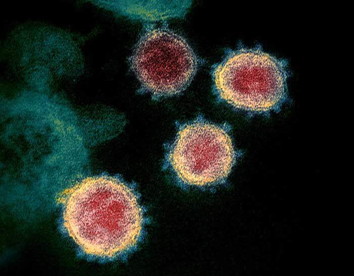 Imagem de microscópio eletrônico mostra o SARS-CoV, vírus que causa que causa o COVID-19